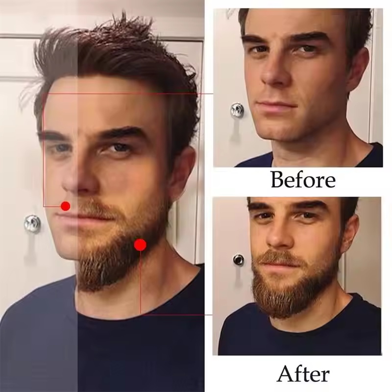 Fast Natural Mature Men Beard  - Plant Growth Regulator 评论和价格